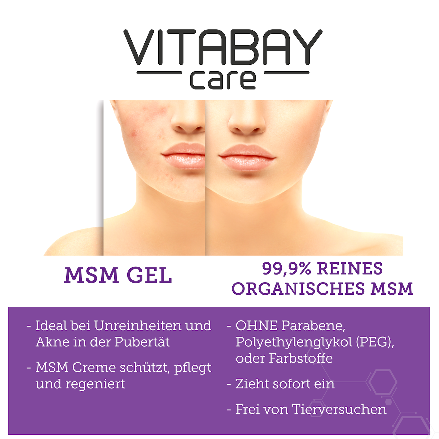 MSM GEL SENSITIVE GEL 250 ML