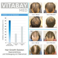 Hair Growth Solution - Haarwachstum Serum - 70 ml